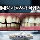 일신치과기공소 네이버블로그