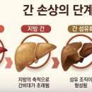 미운 우리 새끼(미우새)에서 가수 린의 어머니 간경화 진단 후 관리 중 이미지