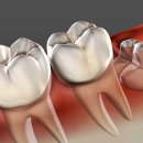 서울휴먼치과의원 이미지