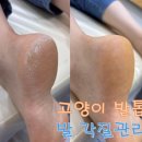 에프터네일(AFTER NAIL) | [대구 발각질제거] 고양이발톱에서 평생숙원 패디플래닝 받고온 후기