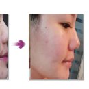 이프네 스킨앤바디 이미지