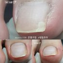네일조아 이미지
