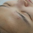 루체스코 | [부천피부관리] 루체스코에서 여드름과 물광케어후기 (친절한 원장님..)