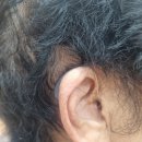 부천연세보청기 이미지