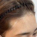 대한두피탈모커버협회부미인두미각 | 온필SMP 두피채움, 두피커버 받고온 후기