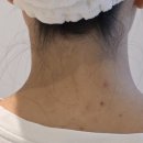 자이글(주) | 자이글온뷰티 페이스&amp;바디 마스크 산소 LED 내돈내산 후기(+사용 일주일 후 사진)