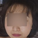 센스미 스킨케어 | 인천피부관리샵 인천에스테틱 센스미스킨케어