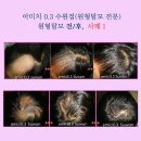 두피 탈모 아미치 0.3 수원점 이미지