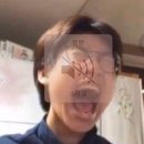 미모의원 | 선릉역피부과 누브의원 압출 + 포텐자 엑소좀 + LDM 후기 ) 에겐녀 되기 프로젝트