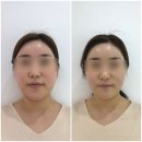 끌리메센텀점 NEW런칭 미친 경락 리얼 후기