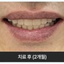 아치치과기공소 이미지