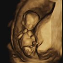 부산광역시기장군보건소 | 임신 12-14주 | 맘스여성병원 1차 기형아 검사, 장꾸맘 각도법 후기