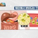 당뇨병 원인 1형 당뇨병 2형 당뇨병 당뇨 이미지