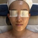 동양메디칼 | 잠실 피부관리 :: 금단비가 잠실본점 작은얼굴 리프팅 얼굴경락 후기