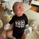 삼성드림소아청소년과의원 | 설소대 단축증 모유수유 아기 염창동 삼성영재소아청소년과의원 설소대 시술 후기, 직수 경과