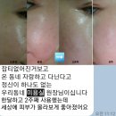 더 클라세움 엑소더마 화장품 크림&amp;세럼 후기 / 싸게사는 TIP