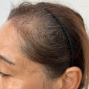 행복한헤어라인