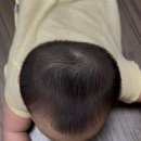 지오크리에이티브 부산경남지사 | [단두 두상교정 #1] 8개월 아기 두상 교정 시작: 큰솔1병원, 지오크리에이티브 부산 방문 후기