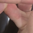 오라클피부과 - 전주시 완산구 여울로 19 | 🌱🩺 오라클피부과 꾸준한 치료 방문 후기! 무좀약 한달치 처방