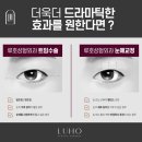 루호성형외과의원 네이버블로그