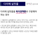 하지정맥류 방치에 따른 부작용은? 이미지