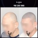 디비전 스칼프 이미지