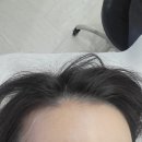 바라다뷰티 | 울산 두피헤어라인 바라다뷰티 미닷 울산탈모
