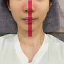 [부평 피부관리] 뷰앤페이셜 에스테틱 : 성형없이 작은얼굴 만들어주는 부평 경락