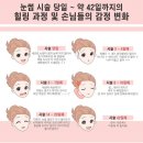 블리즈미