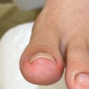 레푸스김포한강 네이버블로그