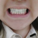 강남애프터치과의원 네이버블로그