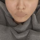 강남대로61길 17 | [올타이트 리프팅 내돈내산] 나는솔로 24기 순자 리프팅 강남역 병원 정보 솔직후기