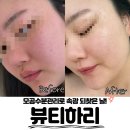 티하리 | 김포피부관리추천, "마산동 뷰티하리" 모공관리와 데콜데로 힐링하고 온 솔직 후기