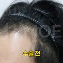 오던모발 이미지