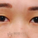 풀림