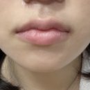 강남 입술 문신 잘하는곳! '유앤케이뷰티' 입술에 생기가 살아남