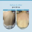 태평양프라자 | 상동 등드름 알라딘필링 후기 1회만에 이렇게 달라졌어요