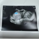 보건소 | 마포구 보건소 임산부등록 후기 준비물, 초기검사, 임산부뱃지, 축하선물