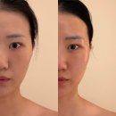 용산-407 | 용산피부관리, 용산에스테틱, 용산경락 "위뷰티" 용산 경락 옆광대 후기