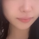 엔디피(NDP) 이미지