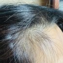 기쁨플러스약국 | 머리숱많아지는법 고민하다 만난 탈모영양제 판토모나 비오틴 플러스맥스