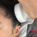 에그뮤즈 스킨스칼프 | 광교피부관리 에그뮤즈 스킨스칼프 광교점 극락케어 후기