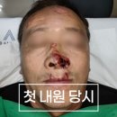 강동실비