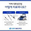 대연동 석회성건염 비수술치료, 밤잠 설치는 어깨 통증 이렇게 잡습니다.