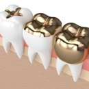 신치과기공소 이미지