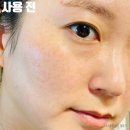 화이트화장품 | 신의눈물 기미화장품 매스티나 화이트매스틱 사용 후기