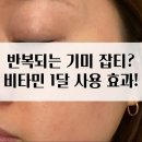 C15 | 반복되는 기미 잡티, 비타민C로 바뀝니다｜비타렉트C15 한 달 사용 후기