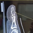 봉평메밀면가 | [부산/당리동] 부산맛집 부산하단칼국수 ' 원조봉평메밀면가 부산본점 ' 부산 하단 본병원 옆 칼국수집...