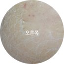 피부1004 이미지