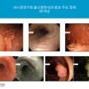 영제의료재단 | 울산 건강검진센터 - 울산편한내과 건강검진센터